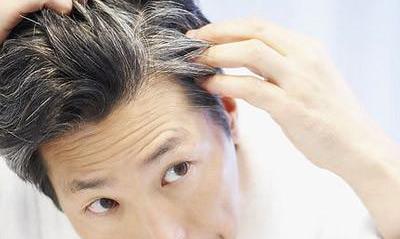 年纪轻轻就有白头发，你可要当心了！